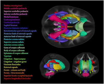 Midlife Cardiovascular Fitness Is Reflected in the Brain's White Matter